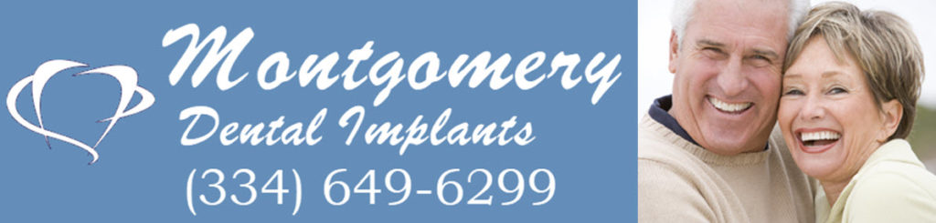 Montgomery Dental Implants Header