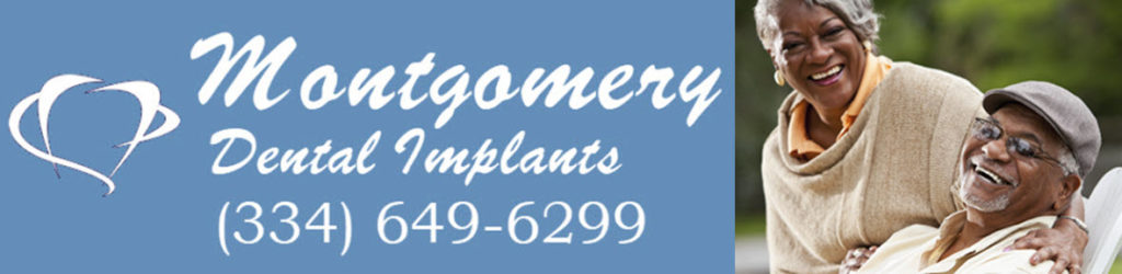 Montgomery Dental Implants Header